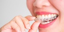 imagen Dacobadental, implantes y ortodoncia invisible Ourense